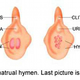 Image for article titled "Restoring Your Virginity, For Him And For Yourself!"